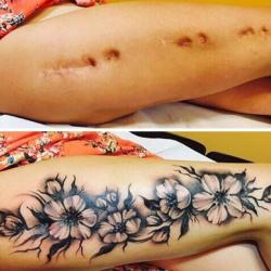 Cacher ses cicatrices avec des tatouages insolites
