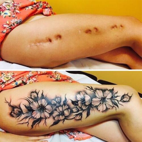 Cacher ses cicatrices avec des tatouages insolites